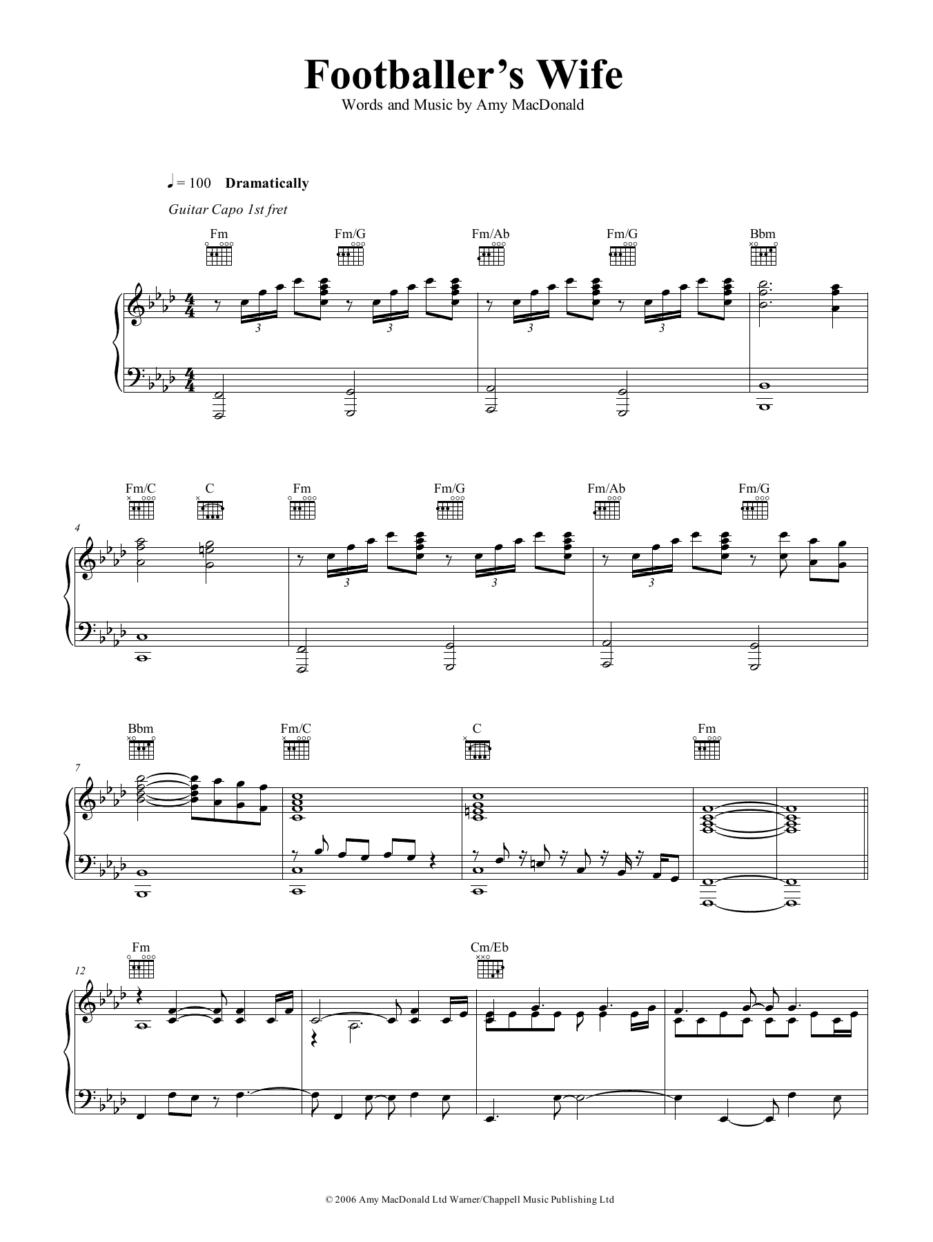 Download Amy MacDonald The Footballer's Wife Sheet Music and learn how to play Piano, Vocal & Guitar (Right-Hand Melody) PDF digital score in minutes