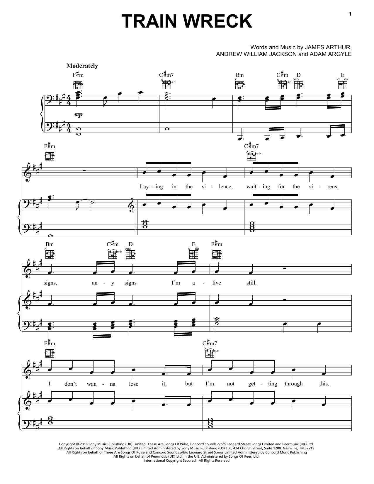 Download James Arthur Train Wreck Sheet Music and learn how to play Piano, Vocal & Guitar Chords (Right-Hand Melody) PDF digital score in minutes