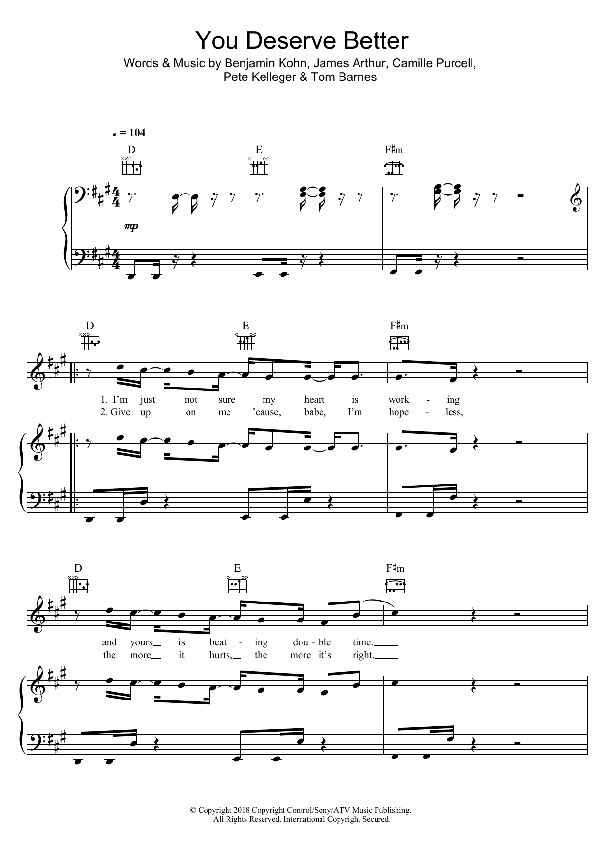 Download James Arthur You Deserve Better Sheet Music and learn how to play Piano, Vocal & Guitar PDF digital score in minutes