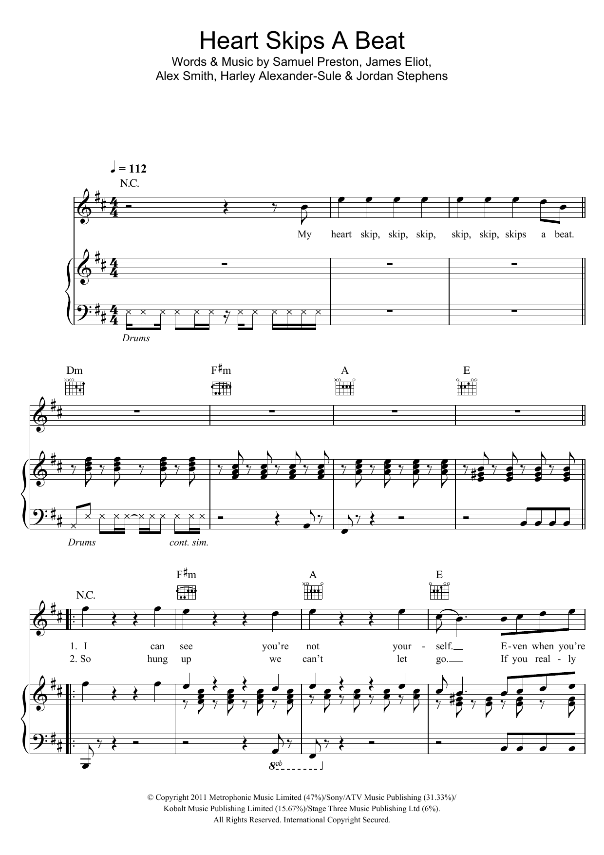 Download Olly Murs Heart Skips A Beat Sheet Music and learn how to play Piano, Vocal & Guitar (Right-Hand Melody) PDF digital score in minutes